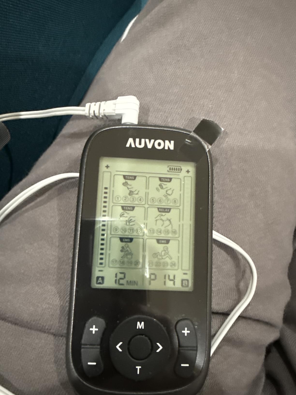 AUVON 3-in-1 TENS Unit Muscle Stimulator, 40 Levels for Gradual Pain Relief | EMS Massage Machine, Drug-Free for Shoulder, Sciatica, Back Pain Relief, 24 Modes Electronic Pulse Massager, 12 TENS Pads customer photo 2